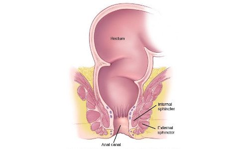 Anal Cancer treatment