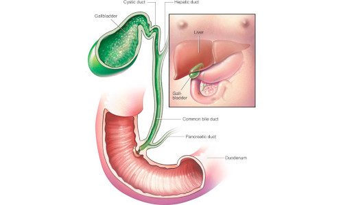 Bile Duct Cancer treatment