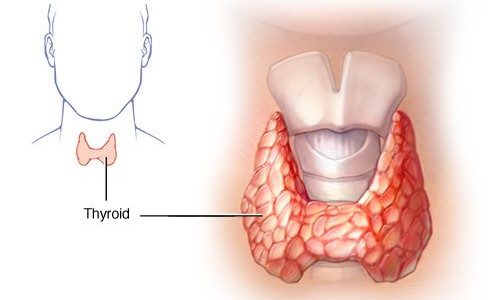 Thyroid Cancer treatment