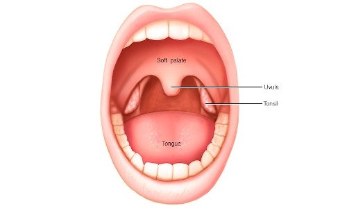 Tonsil Cancer treatment