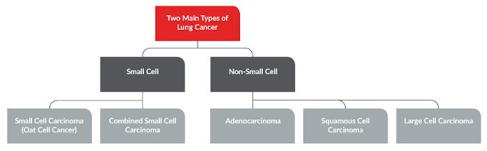 Lung Cancer Surgery