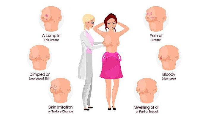 A guide on Breast Cancer