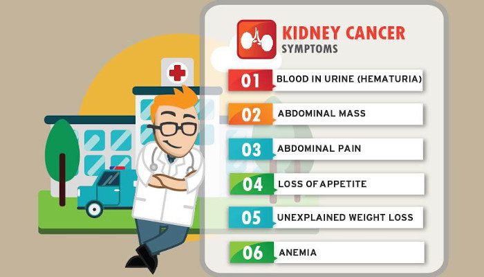 Kidney cancer treatment and diagnosis