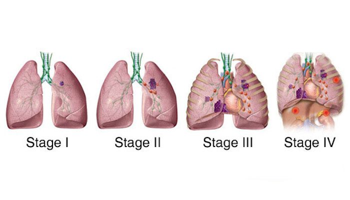 delhi cancer hospital