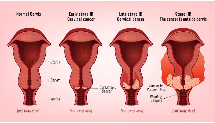 delhi cancer hospital