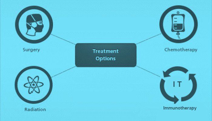 abdominal mesothelioma prognosis