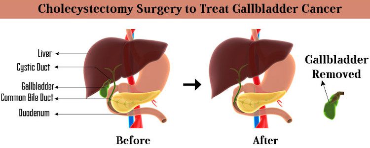 top cancer hospital in delhi