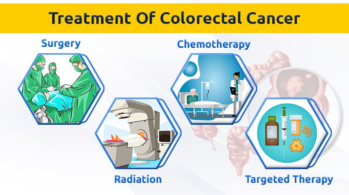 Colorectal cancer treatment options