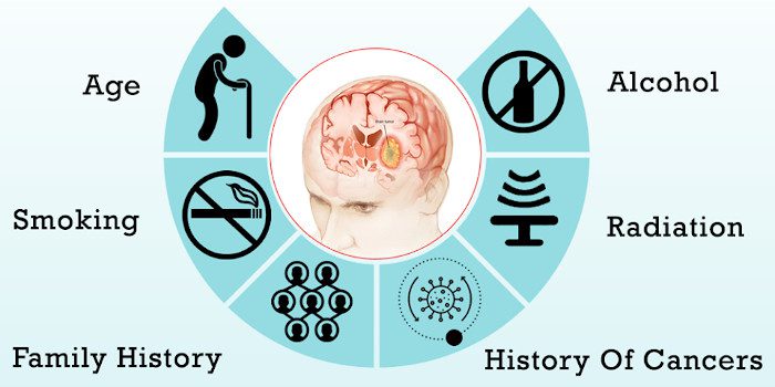 A Guide On Brain Cancer And Its Treatment Oncoplus Hospital
