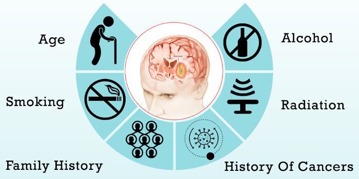 Brain Cancer Causes