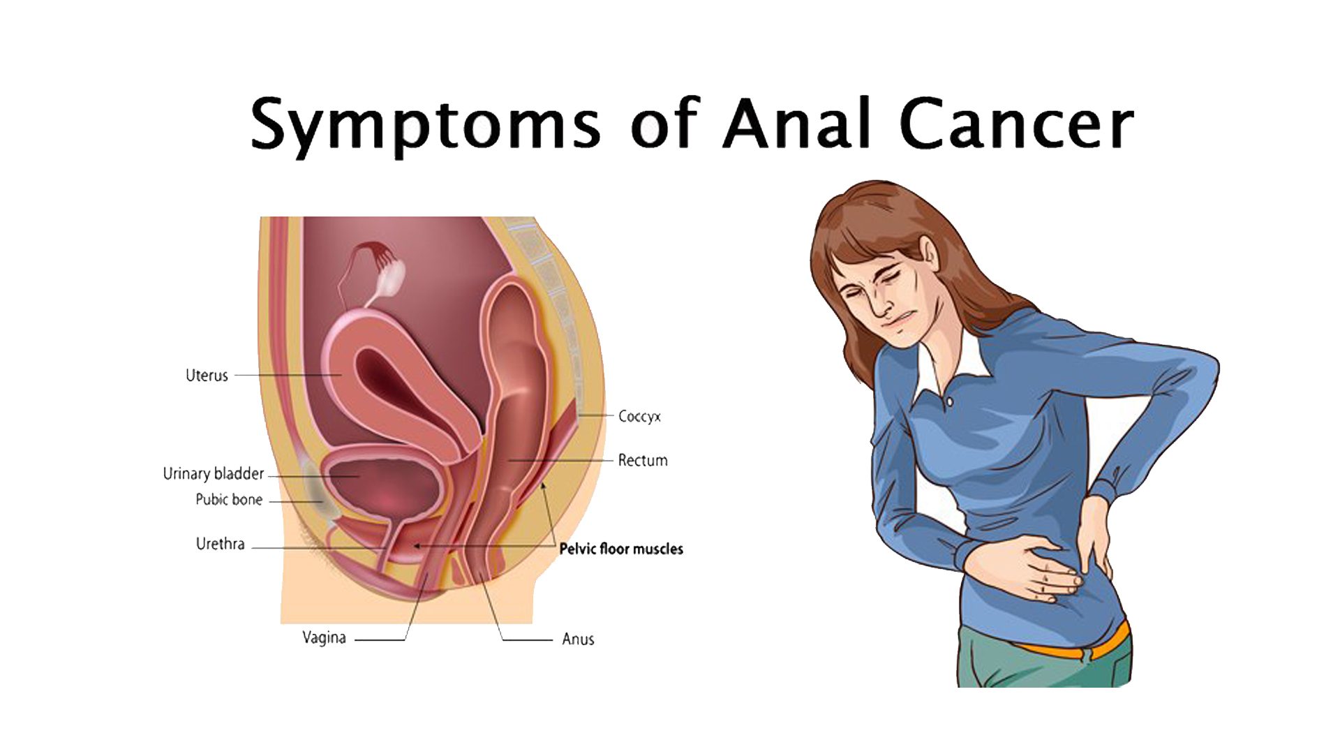 Anal treatment