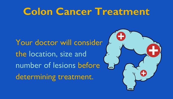 best cancer hospital in delhi