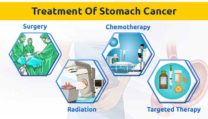 cancer treatment in delhi