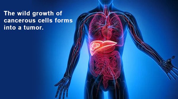 Understanding cancer start, growth and spread in the body