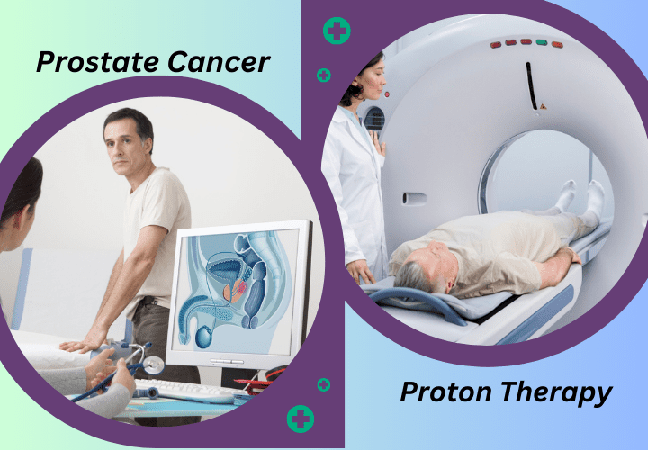 The Benefits of Proton Therapy for Prostate Cancer