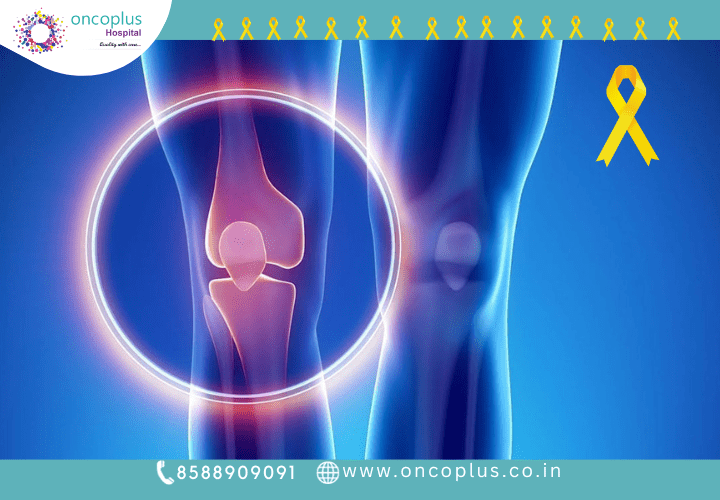 What Does a Sarcoma Lump Look and Feel Like?