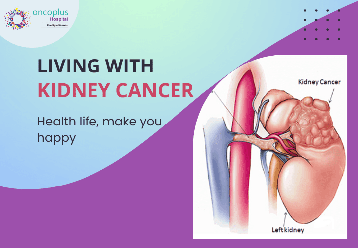 Living with kidney cancer - best cancer treatment in delhi