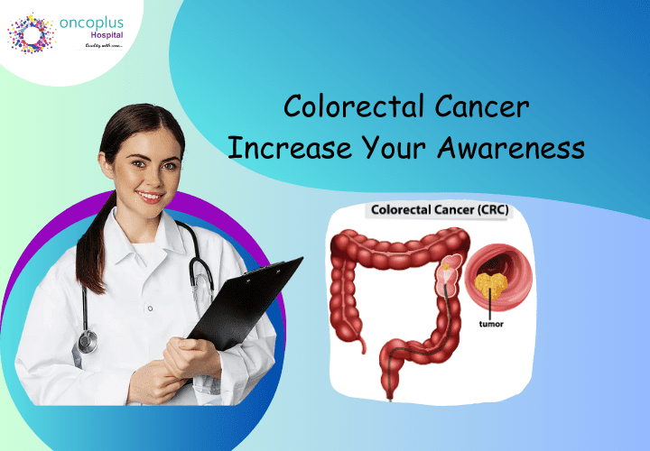 Colorectal Cancer hospital in Delhi