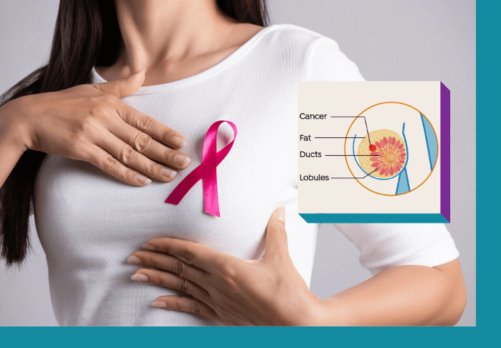 Know everything about Best cancer treatment in Delhi for cancer