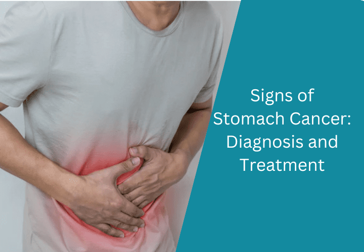 Signs of Stomach Cancer Diagnosis and Treatment
