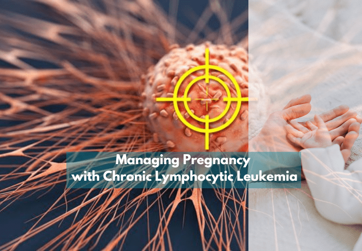 Managing Pregnancy with Chronic Lymphocytic Leukemia