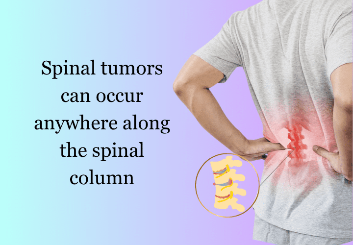 Spinal Cord Tumour