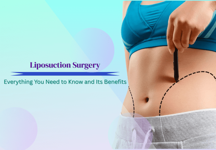 Liposuction Surgery Everything You Need to Know and Its Benefits