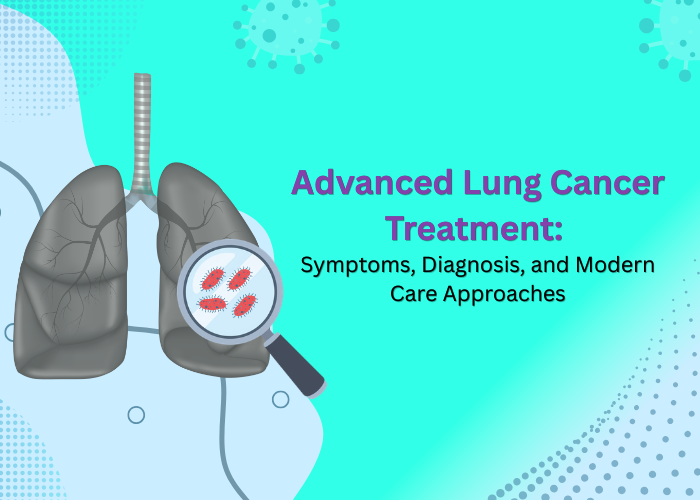 Advanced Lung Cancer Treatment